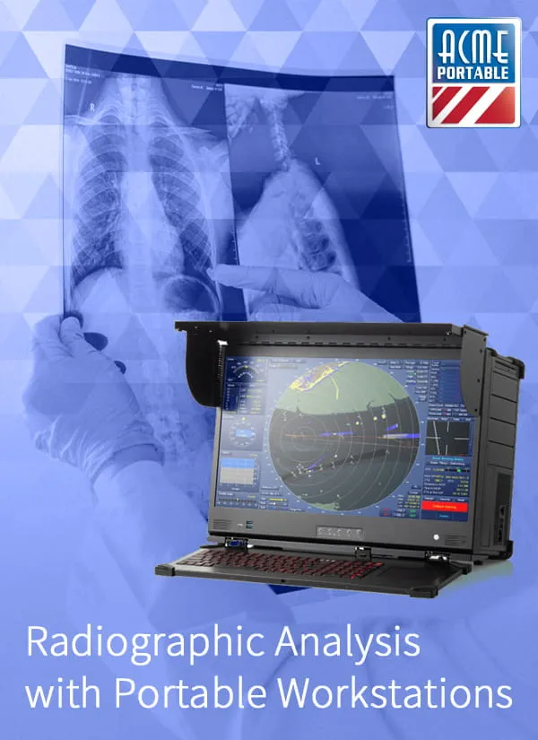 Accelerating Radiographic Analysis with Next-Gen Portable Workstations thumbnail