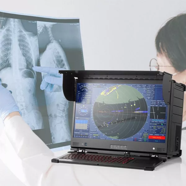 Accelerating Radiographic Analysis with Next-Gen Portable Workstations thumbnail